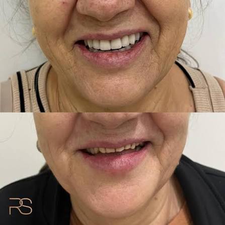 Devolução de harmonia ao sorriso