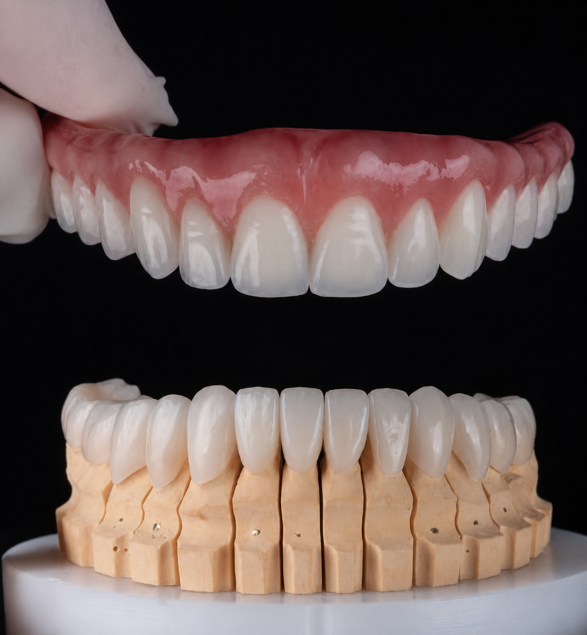 Prótese sobre implantes e cerâmicas